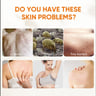 Acne, mites, and tiny bumps on skin, itching, sweating odor, dry skin issues.